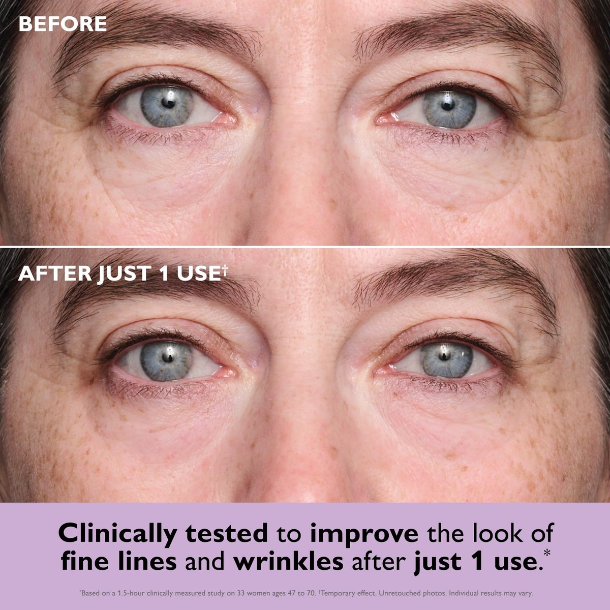 Peter Thomas Roth Instant FIRMx Collagen Tightening Eye Patches - Firming Under-Eye Bags and Wrinkles - 8 Count Avelisse