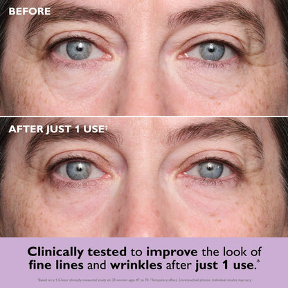 Peter Thomas Roth Instant FIRMx Collagen Tightening Eye Patches - Firming Under-Eye Bags and Wrinkles - 8 Count Avelisse