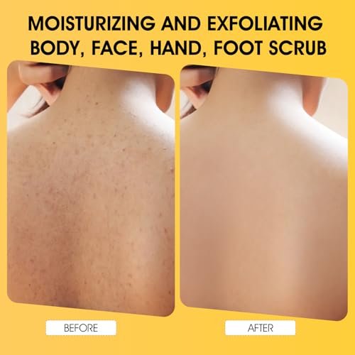 VOERUY Turmeric Body Scrub with 10% AHA/BHA & Vitamin C - Exfoliating Body Scrub for Smooth, Moisturized Skin - Body Exfoliator for Hands, Feet, Bikini Area - 11.3 oz - görsel 10