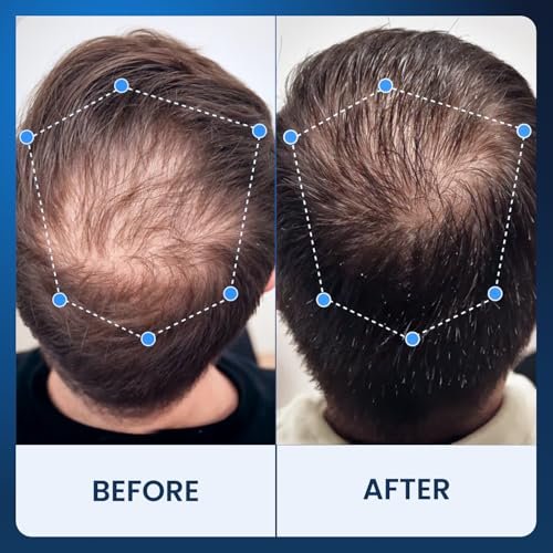 Fleava Hair Regrowth Serum for Thinning Hair, 30ml – Clinically Backed Peptides, Biotin, Ginseng & Scutellaria – Supports Hair Growth, Strengthens Roots, and Promotes Healthier Scalp Avelisse