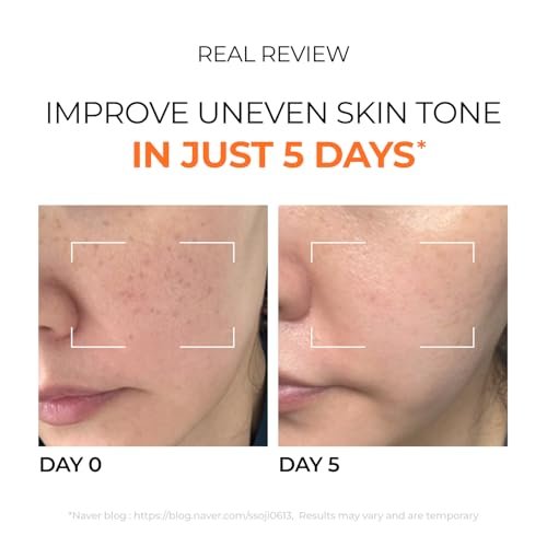 DOMINAS Hyper P-Toning 10% Tranexamic Acid Serum - Discoloration Correcting & Brightening Serum with TXA, 5% AHA, 5% Niacinamide, Dark Spots, Pore Care, Korean Skincare, 1.01 fl oz Avelisse