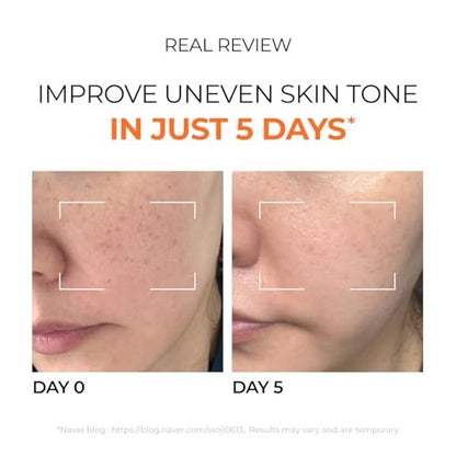 DOMINAS Hyper P-Toning 10% Tranexamic Acid Serum - Discoloration Correcting & Brightening Serum with TXA, 5% AHA, 5% Niacinamide, Dark Spots, Pore Care, Korean Skincare, 1.01 fl oz Avelisse