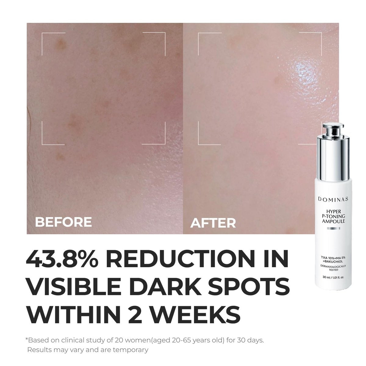 DOMINAS Hyper P-Toning 10% Tranexamic Acid Serum - Discoloration Correcting & Brightening Serum with TXA, 5% AHA, 5% Niacinamide, Dark Spots, Pore Care, Korean Skincare, 1.01 fl oz Avelisse