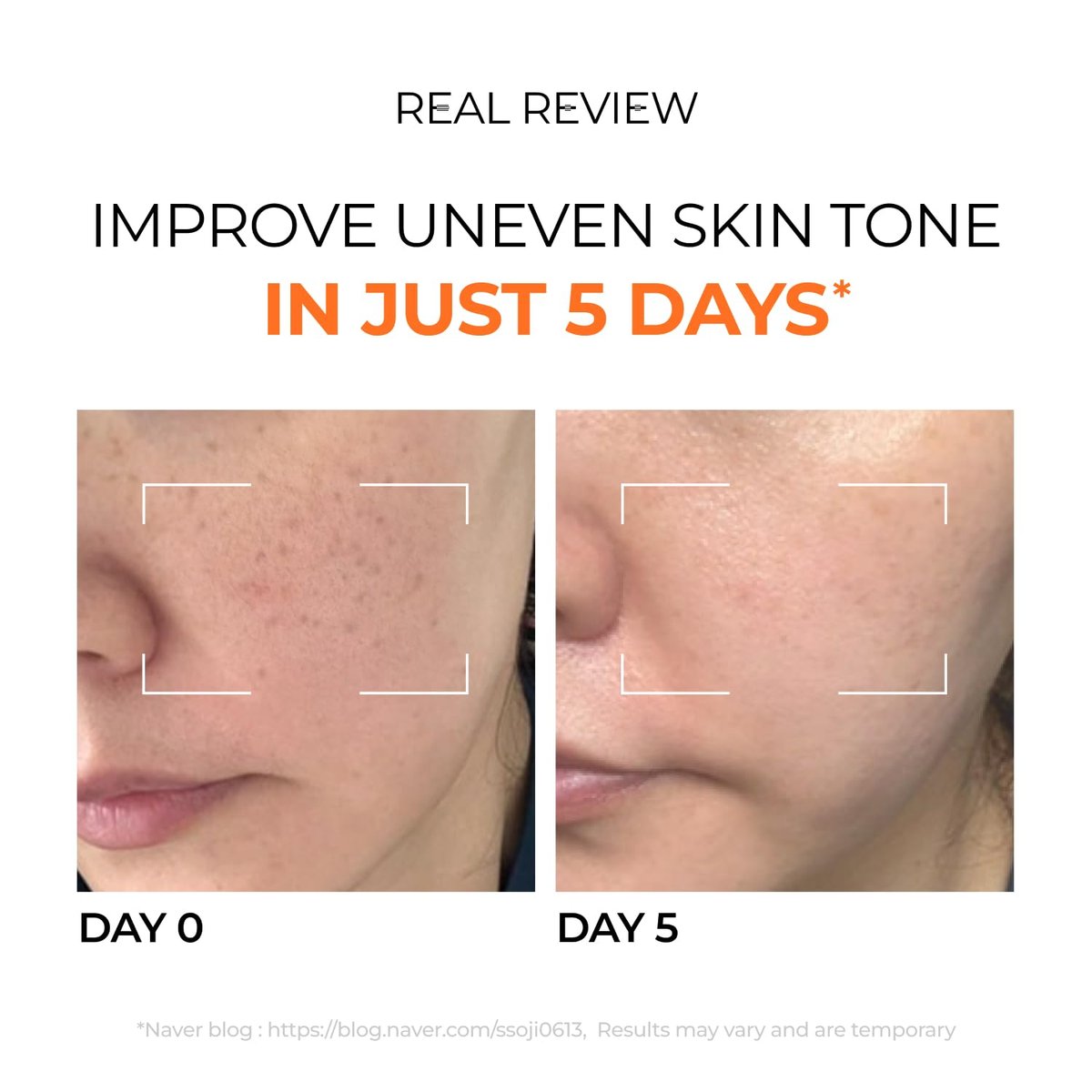 DOMINAS Hyper P-Toning 10% Tranexamic Acid Serum - Discoloration Correcting & Brightening Serum with TXA, 5% AHA, 5% Niacinamide, Dark Spots, Pore Care, Korean Skincare, 1.01 fl oz Avelisse