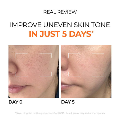 DOMINAS Hyper P-Toning 10% Tranexamic Acid Serum - Discoloration Correcting & Brightening Serum with TXA, 5% AHA, 5% Niacinamide, Dark Spots, Pore Care, Korean Skincare, 1.01 fl oz Avelisse