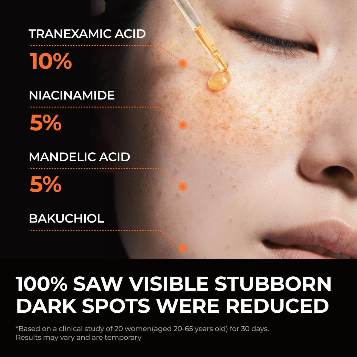 DOMINAS Hyper P-Toning 10% Tranexamic Acid Serum - Discoloration Correcting & Brightening Serum with TXA, 5% AHA, 5% Niacinamide, Dark Spots, Pore Care, Korean Skincare, 1.01 fl oz Avelisse