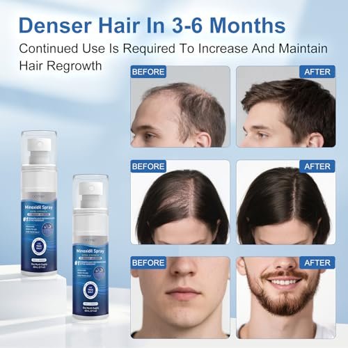 5% Minoxidil Extra Strength Hair Regrowth Spray for Men and Women - 7 Pack (60ml Each) | Thicker, Healthier Hair & Beard Growth Treatment Avelisse