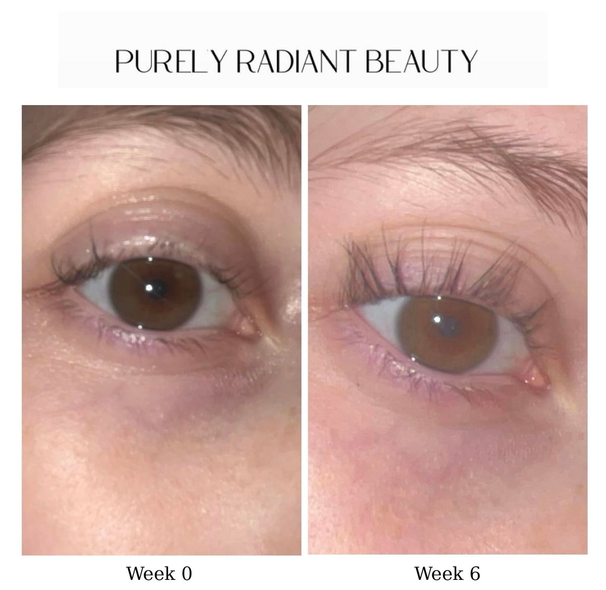 Purely Radiant Beauty Eyelash Growth Serum – Prostaglandin-Free Lash & Brow Enhancer for Longer, Thicker Lashes – Vegan, Cruelty-Free, Castor Oil Based – Natural Lash Serum for Growth Avelisse