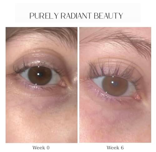 Purely Radiant Beauty Eyelash Growth Serum – Prostaglandin-Free Lash & Brow Enhancer for Longer, Thicker Lashes – Vegan, Cruelty-Free, Castor Oil Based – Natural Lash Serum for Growth Avelisse