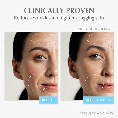 EnaSkin Retinol Collagen Face Cream – Anti Aging Wrinkle Cream for Women, Neck & Décolleté Moisturizer with 7% Hyaluronic Acid Serum, Day/Night Skin Firming & Tightening, 1.7 Oz Avelisse