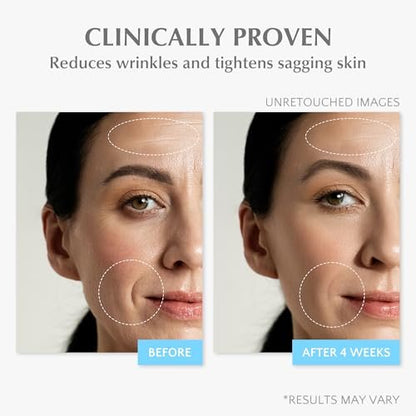EnaSkin Retinol Collagen Face Cream – Anti Aging Wrinkle Cream for Women, Neck & Décolleté Moisturizer with 7% Hyaluronic Acid Serum, Day/Night Skin Firming & Tightening, 1.7 Oz Avelisse