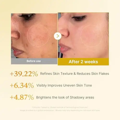 medicube Kojic Acid Turmeric Smoothing Toner for Face & Body | Lightweight Toner for Balancing Uneven Skin Tone & Texture | Niacinamide, Glycolic Acid for Clear Glass Skin | 8.45 fl.oz Avelisse