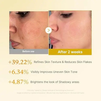 medicube Kojic Acid Turmeric Smoothing Toner for Face & Body | Lightweight Toner for Balancing Uneven Skin Tone & Texture | Niacinamide, Glycolic Acid for Clear Glass Skin | 8.45 fl.oz Avelisse
