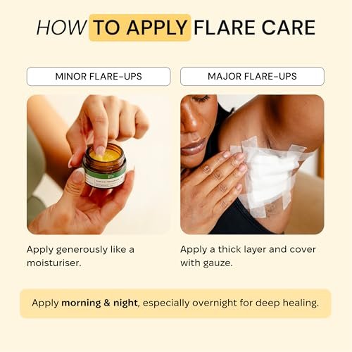 MyMagicHealer Comfort Flare Care | 1oz All-Natural Salve for Skin Flare-Ups Avelisse