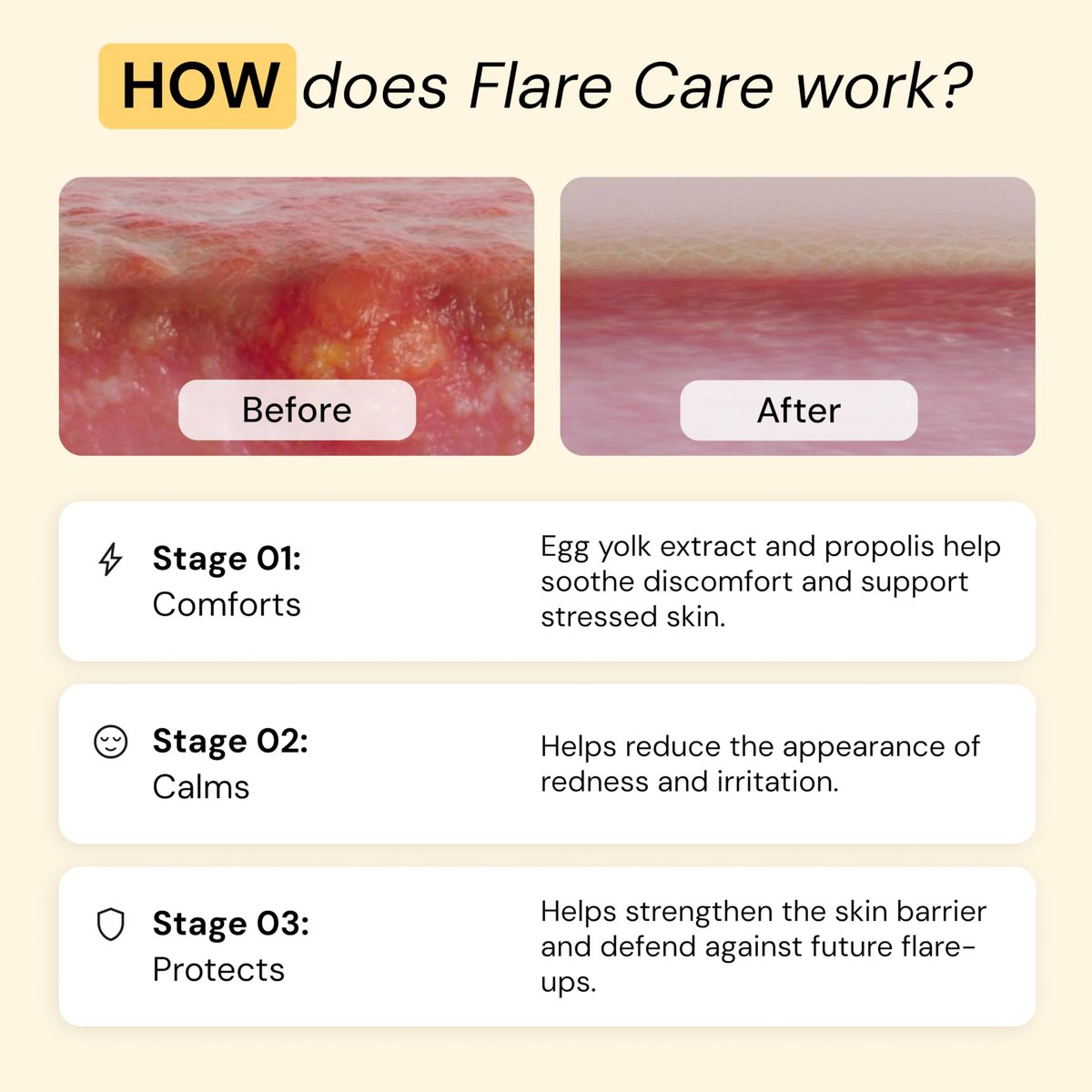 MyMagicHealer Comfort Flare Care | 1oz All-Natural Salve for Skin Flare-Ups Avelisse