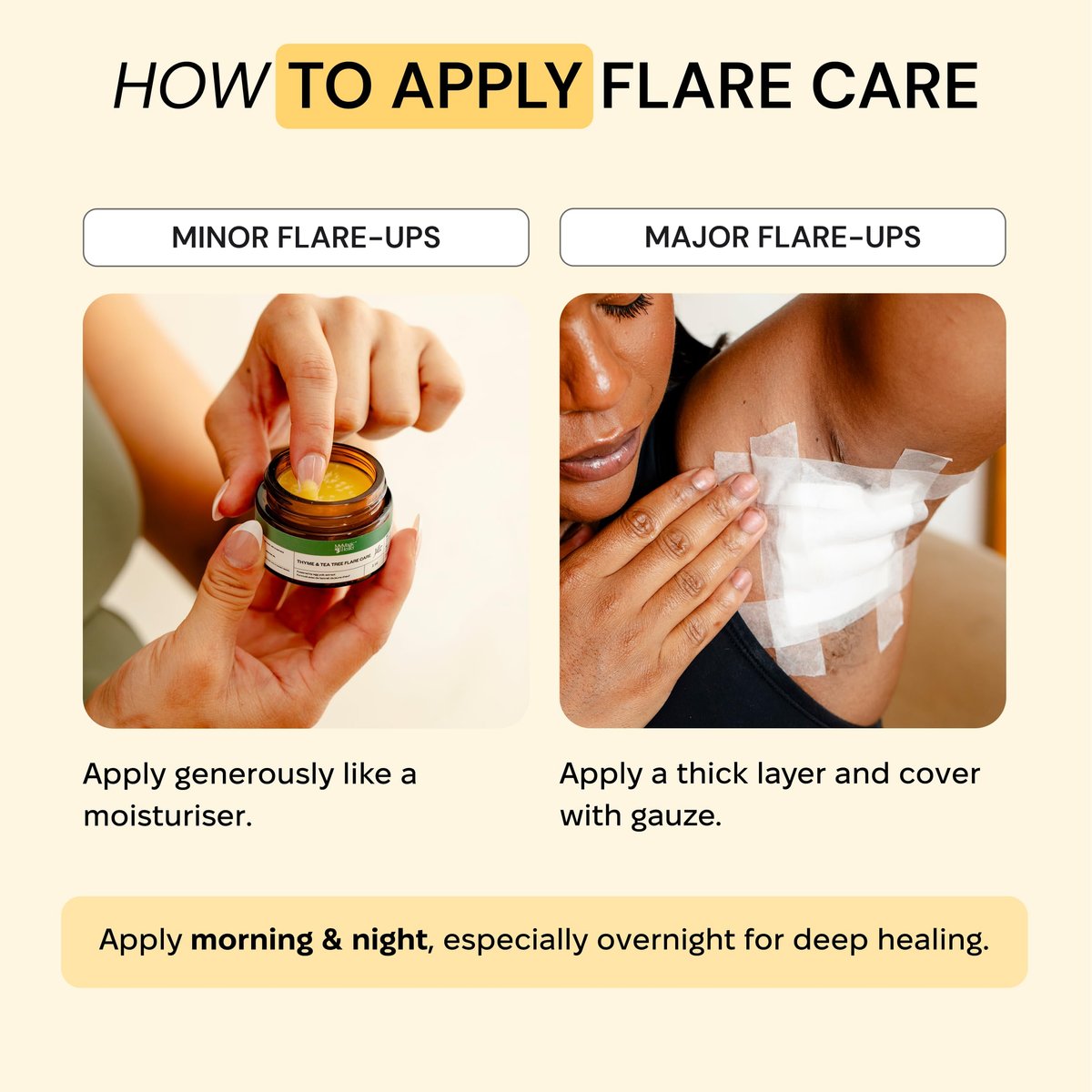 MyMagicHealer Comfort Flare Care | 1oz All-Natural Salve for Skin Flare-Ups Avelisse