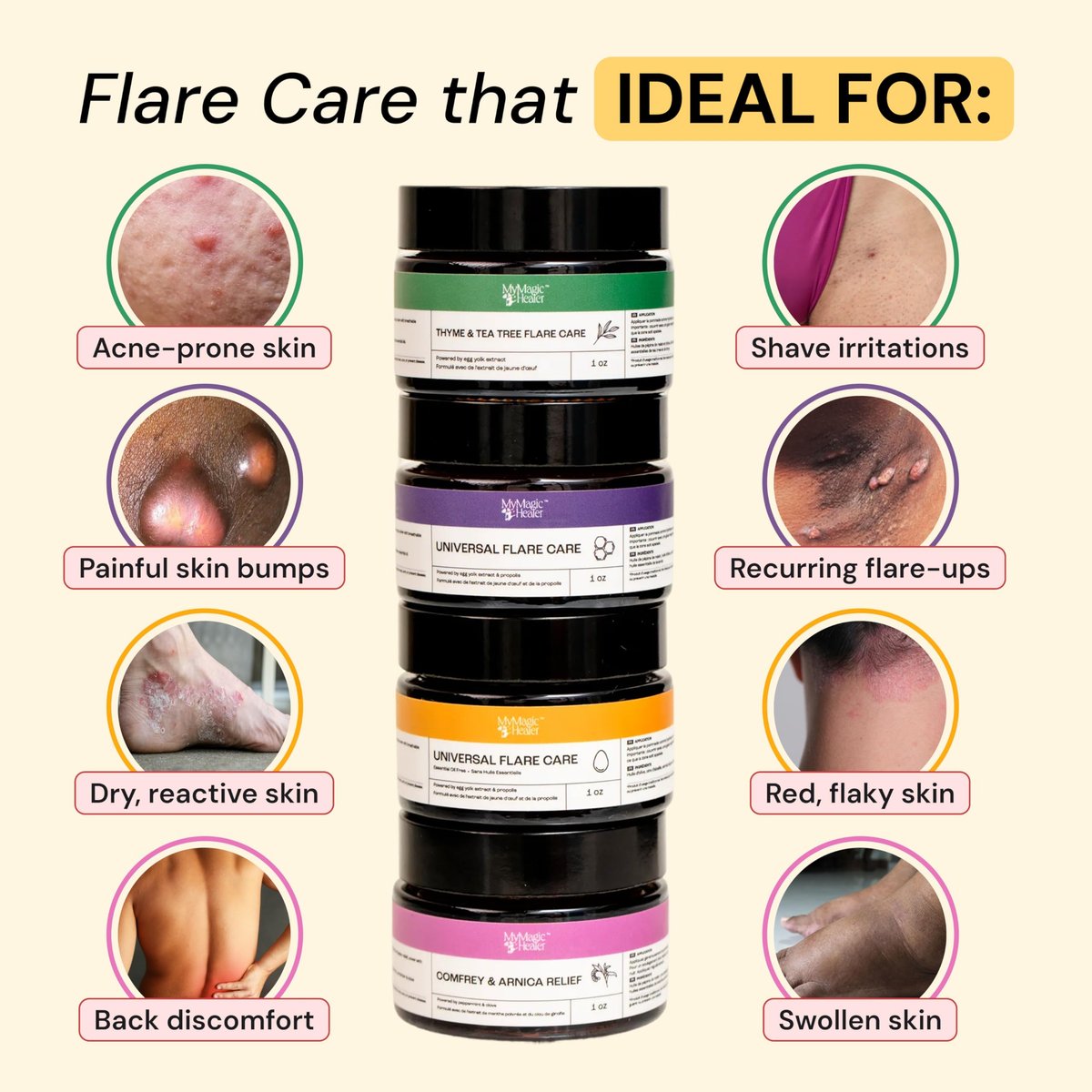 MyMagicHealer Comfort Flare Care | 1oz All-Natural Salve for Skin Flare-Ups Avelisse