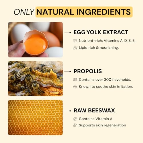 MyMagicHealer Comfort Flare Care | 1oz All-Natural Salve for Skin Flare-Ups Avelisse
