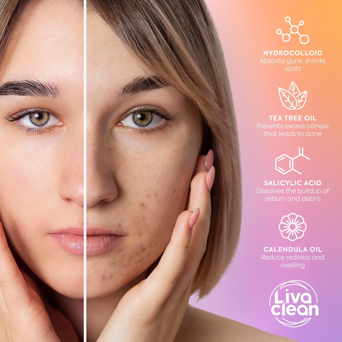 Livaclean 120 CT Pimple Patches with Salicylic Acid, Tea Tree & Calendula Oil – Four Sizes Acne Patches for Face, Hydrocolloid Zit Dots, Invisible Acne Stickers - görsel 12