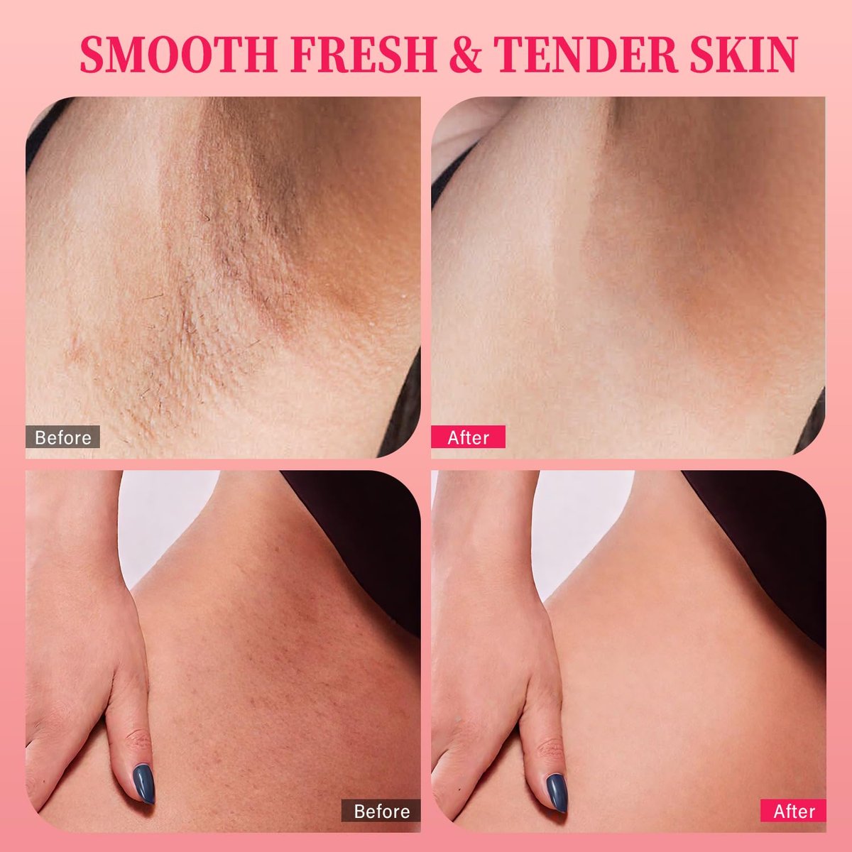Bikini Area Exfoliator with 10% AHAs BHA & Vitamin C - Exfoliating Body Scrub for Ingrown Hair, Underarm Bumps, Dark Spots, Moisturize & Brighten - Sensitive Skin Safe, 7.76 oz - görsel 7