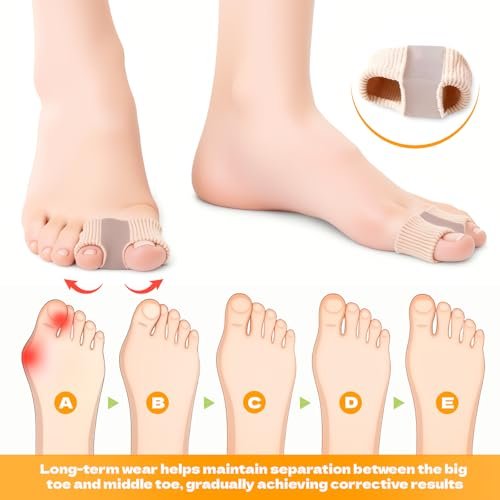 LeaOcaao 4 PCS Gel Bunion Toe Separators with 2 Loops for Overlapping Toes – Gel Toe Spacers & Bunion Corrector for Women and Men - görsel 6