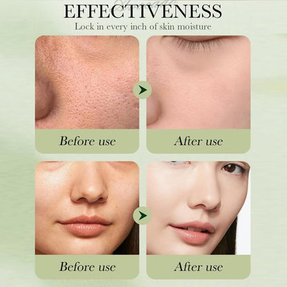 6pcs Avocado Skincare Set - Hydrating & Anti-Aging Facial Kit for Women and Men
