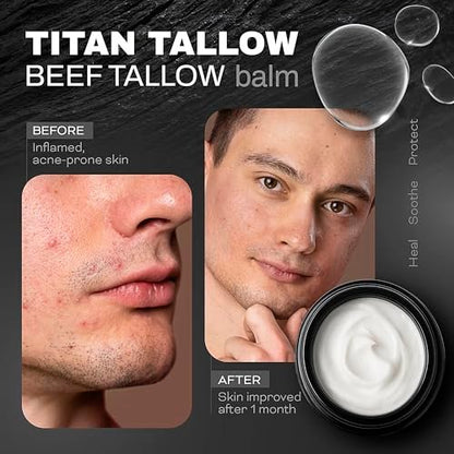 Organic Grass-Fed Beef Tallow Balm with Magnesium & Manuka Honey – Moisturizing Face & Body Cream for Sleep, Leg Cramps & Muscle Relaxation Avelisse