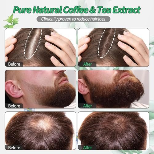 Orrenaturals Hair Revival Ampoule 3% Rosemary Hair Growth Serum Roll On - 30ml Scalp Treatment for Hair Loss & Thinning Avelisse