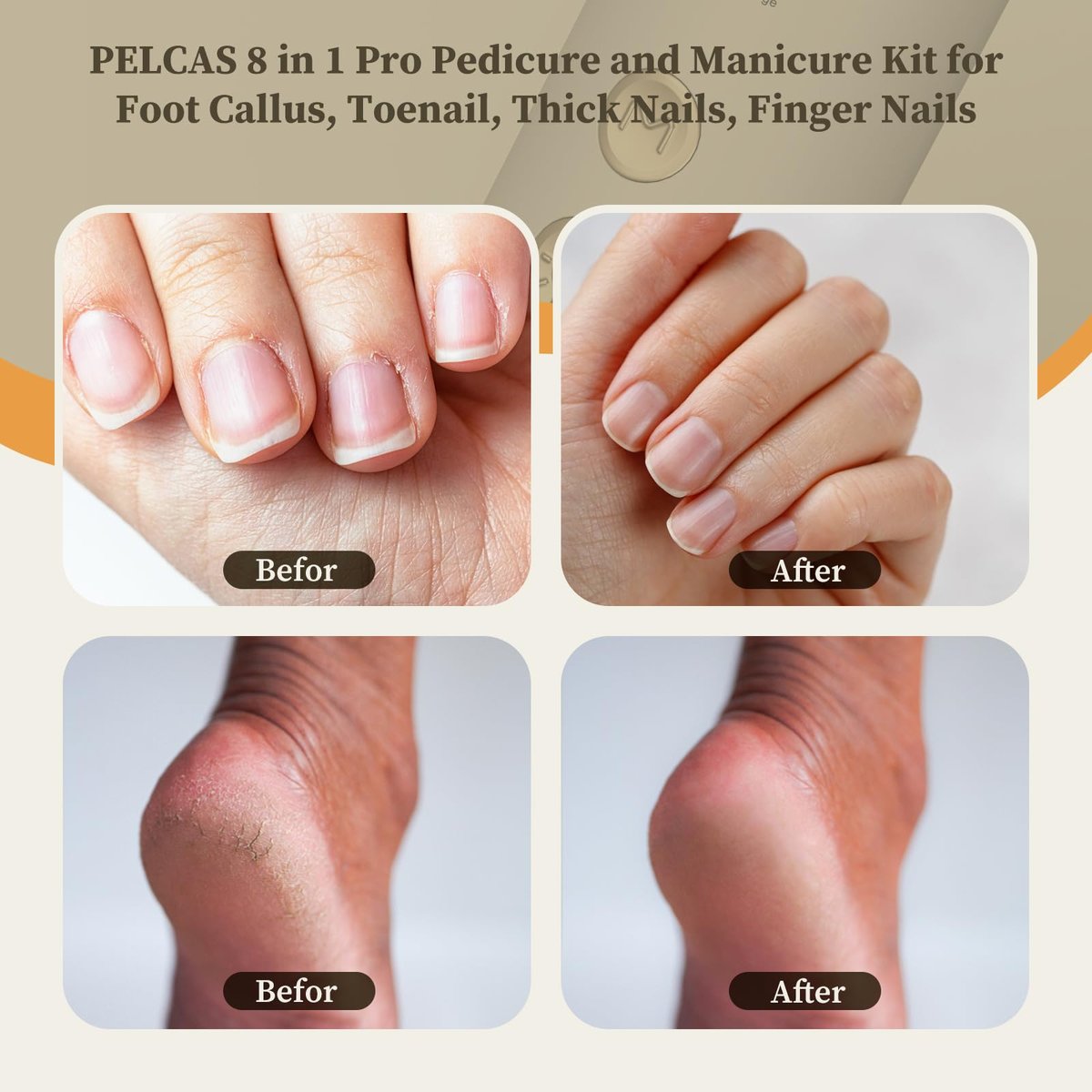 PELCAS 8-in-1 Cordless Nail Drill: Electric Nail Filer with LED Light & Foot Callus Remover - 5 Speeds, Rechargeable, Golden Avelisse