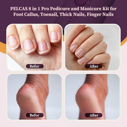 PELCAS Toenail Grinder for Thick Toenails - 8 in 1 Manicure & Pedicure Kit, Cordless Nail Drill with LED Light, Electric Foot Callus Remover, 5 Speeds, Pink Avelisse