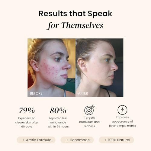 Eliré Clear Skin Balm – Ultimate Night Formula for Breakouts, Pimples, Blemishes – Fade Marks, Even Tone, Prevent New Pimples, Soften Fine Lines & Pores - görsel 4