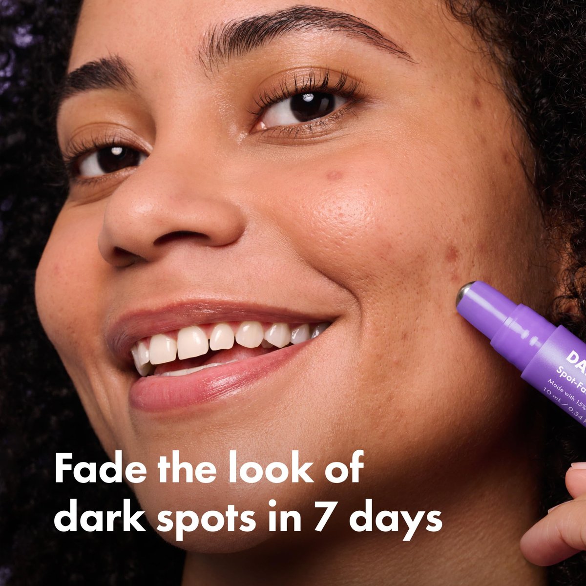 Hero Cosmetics Dark Spot Correct Spot-Fading 15% Vitamin C Serum with Hyaluronic Acid – Improves Post-Blemish Marks in 7 Days – Twist Applicator & Rollerball Tip – 10mL - görsel 3