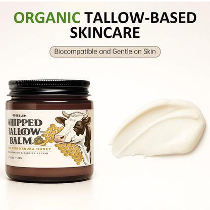 Roseblem Whipped Tallow Balm for Face – 100% Grass-Fed Organic Beef Tallow Cream with Manuka Honey & Beeswax – Nourishing & Repairing Moisturizer for Sensitive, Dry, or Eczema-Prone Skin, 4.2 oz