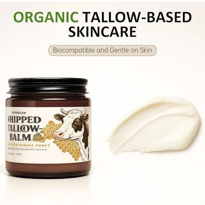 Roseblem Whipped Tallow Balm for Face – 100% Grass-Fed Organic Beef Tallow Cream with Manuka Honey & Beeswax – Nourishing & Repairing Moisturizer for Sensitive, Dry, or Eczema-Prone Skin, 4.2 oz