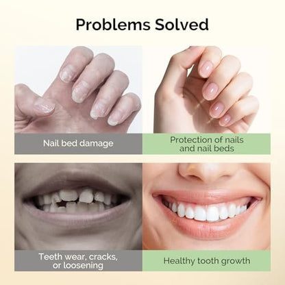 MelodySusie 15ML Nail Biting Treatment - Quick-Dry, Bitter-Tasting Polish to Stop Thumb Sucking & Nail Biting, Helps Repair Damaged Nails for Kids and Adults (0.53 fl oz)