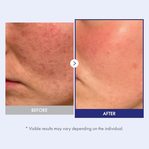 TOSOWOONG Panthenol 20 Barrier Cream – 20% Panthenol, Ceramides & Hyaluronic Acid – Deep Hydration Face Moisturizer – Korean Skincare for All Skin Types – 1.69 fl oz Avelisse