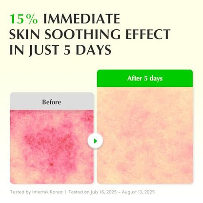 EQQUALBERRY Aloe PDRN Calming Smoothie Serum – Soothing Korean Skin Care for Sensitive Skin, Cica & Aloe for Repair, Hydrating & Radiant Glow, Non-Comedogenic (1.01oz / 30ml) Avelisse
