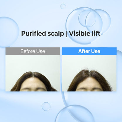 KUNDAL Hyaluronic Acid Airy Volume Shampoo and Treatment Set – Blossom Breeze, 16.9 fl oz Each Avelisse