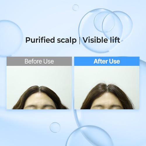 KUNDAL Hyaluronic Acid Airy Volume Shampoo and Treatment Set – Blossom Breeze, 16.9 fl oz Each Avelisse