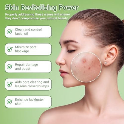 Eofot 14% Azelaic Acid Acne Cream – Helps Improve Appearance of Acnes, Acido Azelaico Face Moisturizer for Sensitive, Oily, Dry Skin, 1 Fl Oz
