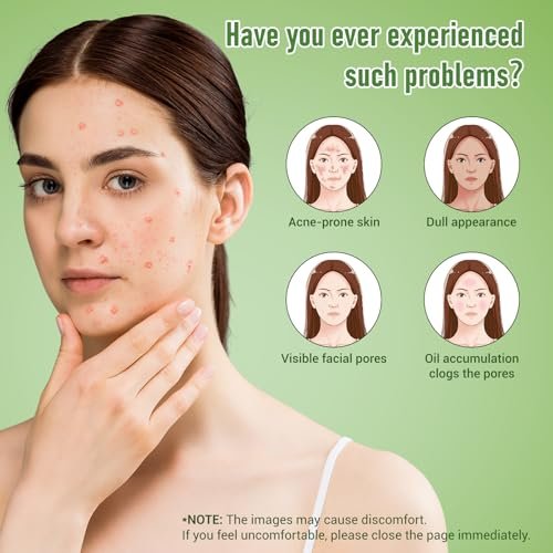Eofot 14% Azelaic Acid Acne Cream – Helps Improve Appearance of Acnes, Acido Azelaico Face Moisturizer for Sensitive, Oily, Dry Skin, 1 Fl Oz - görsel 8