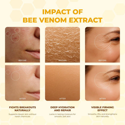 MONIER Bee Venom Cream Enhanced Formula - Hydrating, Smoothing, Firming, Wrinkle-Reducing Face Moisturizer, 1 Fl Oz Avelisse
