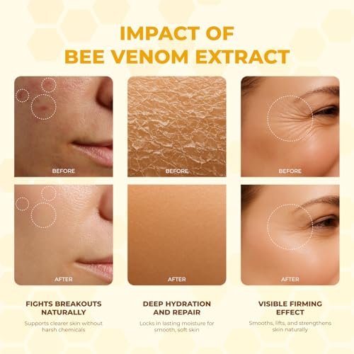 MONIER Bee Venom Cream Enhanced Formula - Hydrating, Smoothing, Firming, Wrinkle-Reducing Face Moisturizer, 1 Fl Oz Avelisse