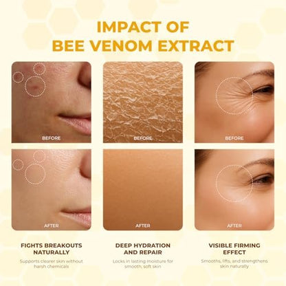 MONIER Bee Venom Cream Enhanced Formula - Hydrating, Smoothing, Firming, Wrinkle-Reducing Face Moisturizer, 1 Fl Oz Avelisse