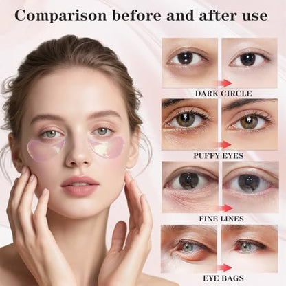 Nicotinamide Under Eye Patches (40 Pairs) – Hydrogel Eye Mask for Puffy Eyes, Dark Circles & Fine Lines with Collagen & Hyaluronic Acid – Skincare Gift for Women