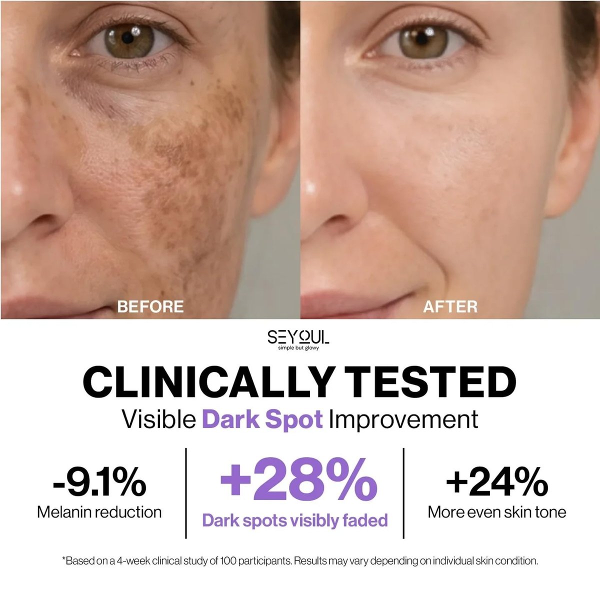 SEYOUL Meso White Facial Serum – Brightening Vitamin C, Niacinamide & Collagen Serum for Dark Spots & Uneven Skin Tone – 6 Vials (0.17 fl oz Each) Avelisse