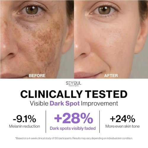 SEYOUL Meso White Facial Serum – Brightening Vitamin C, Niacinamide & Collagen Serum for Dark Spots & Uneven Skin Tone – 6 Vials (0.17 fl oz Each) Avelisse