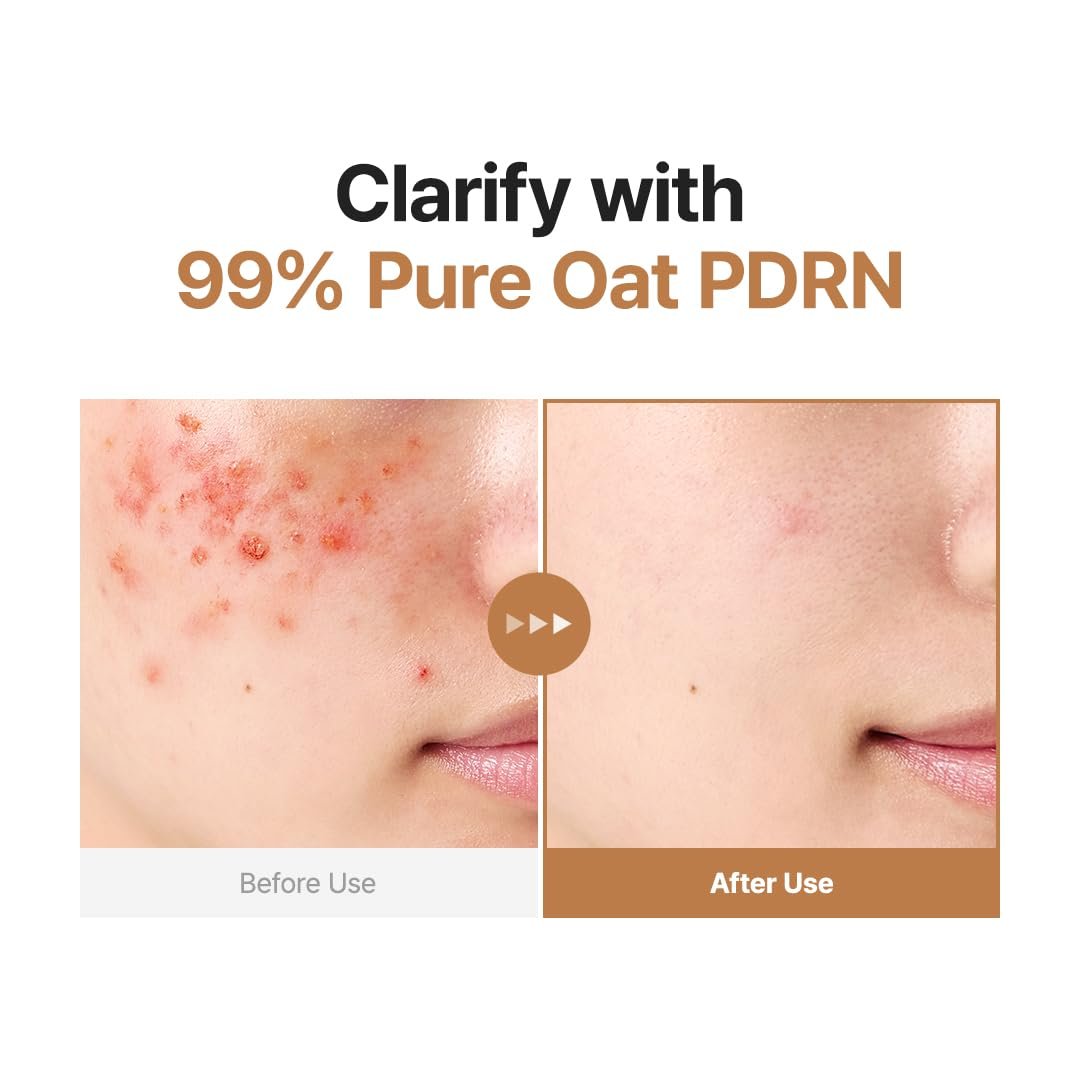 PURITO Oat PDRN Gentle Refining Toner – 200 mL (6.76 fl.oz) | Korean Exfoliating Toner with 99% Pure Oat PDRN for Acne-Prone Skin, Vegan & Non-Comedogenic Avelisse