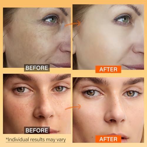 Vitamin C Face Moisturizer with Turmeric & Niacinamide - Brightening Anti-Aging Cream for Dark Spots, Wrinkles & Uneven Tone - Hydrating Face Moisturizer for All Skin Types, 2.3 oz Avelisse