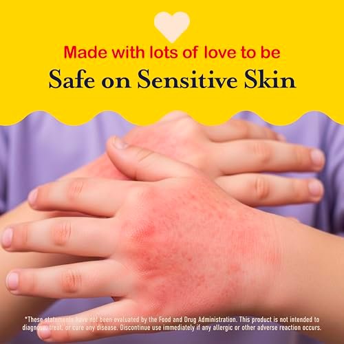 Hypochlorous Acid Spray for Kids – Soothes Diaper Rash, Baby Acne, Eczema & Minor Cuts – Non-Toxic, No Sting, 4 oz Avelisse